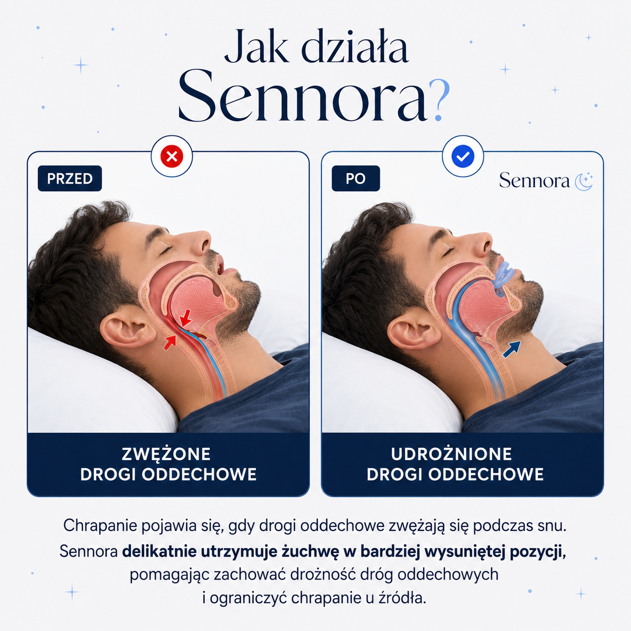Sennora - Nakładka przeciw chrapaniu. Twoja ulga od pierwszej nocy.